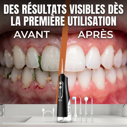 Aquavel – Jet Dentaire Portable Rechargeable