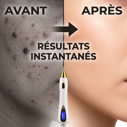 Dermive – Stylo Plasma Grain de Beauté