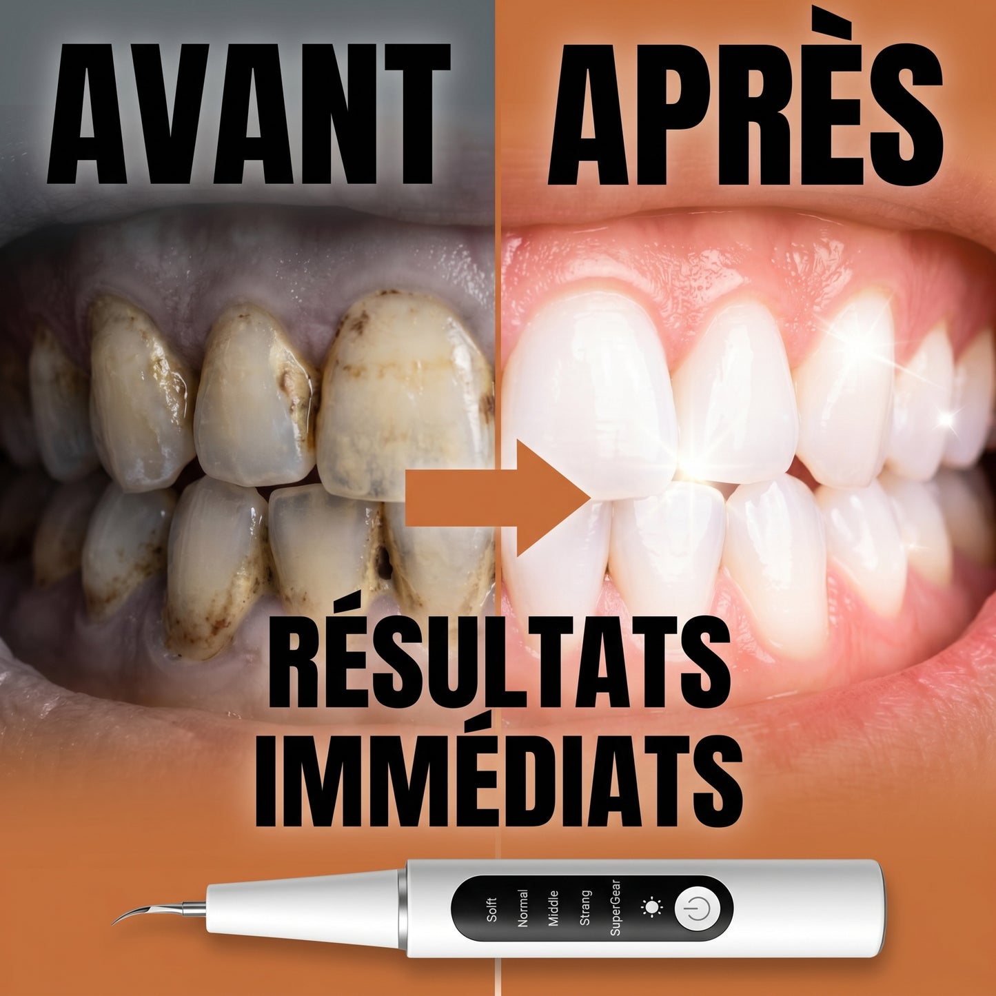 Denvilux – Détartreur Dentaire Électrique Rechargeable